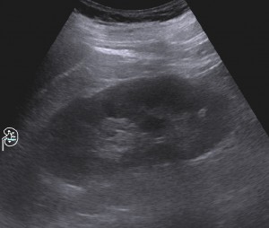 Aufnahme einer Nierensonografie eines Urologen