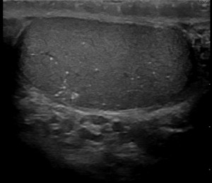 Aufnahme einer Hodensonografie eines Urologen
